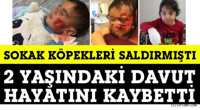 Köpeklerin saldırdığı 2 yaşındaki Davut, maalesef hayata tutunamadı