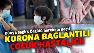 Korona bağlantılı çocuk hastalığı için Dünya Sağlık Örgütü harekete geçti