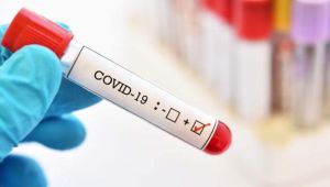 Organ nakli hastalarına koronavirüs uyarısı