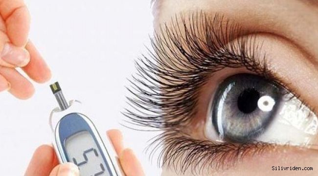 Şeker hastalarının göz tedavisinde uygulanan güncel yöntemler